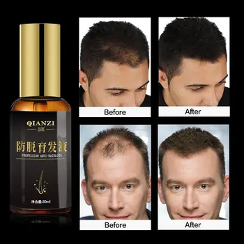 

Fast Hair Growth Serum Essential Oils Essence Anti Preventing Hair Lose Liquid Damaged Hair Repair Growing Women Men Hair Care