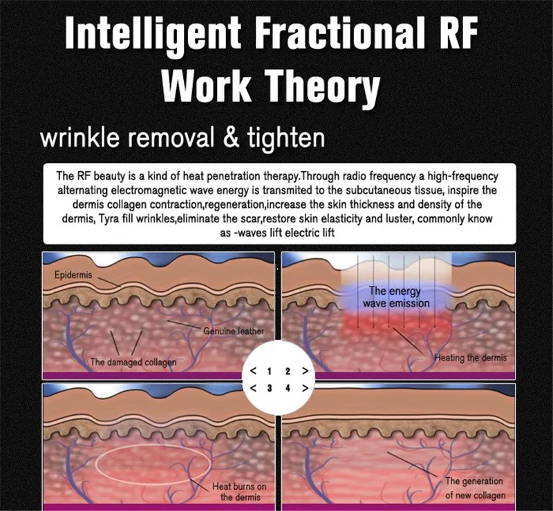 Термаж точечная матрица Радиочастотное оборудование для ухода для подтяжки лица Подтяжка кожи удаление морщин Интеллектуальный массажер для лица