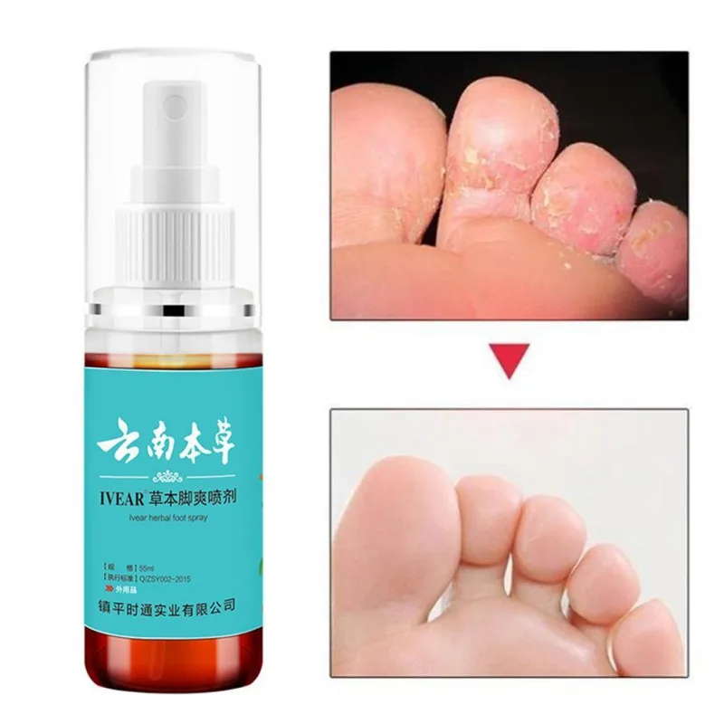

Herbal Anti-fungal Athlete Foot Spray Antibacterial Deodorant Powder Anti Itch Sweat Odor Foot Liquid Anti-fungi Spray Feet Care