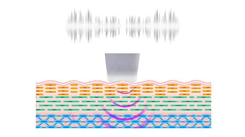 9602452026_990214831