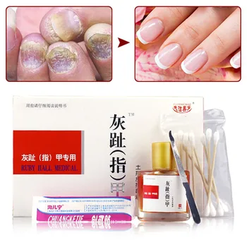 

25ml Nail Fungal Treatment Set Onychomycosis Removal Anti Fungus Toenail Nails Care Repair Liquid