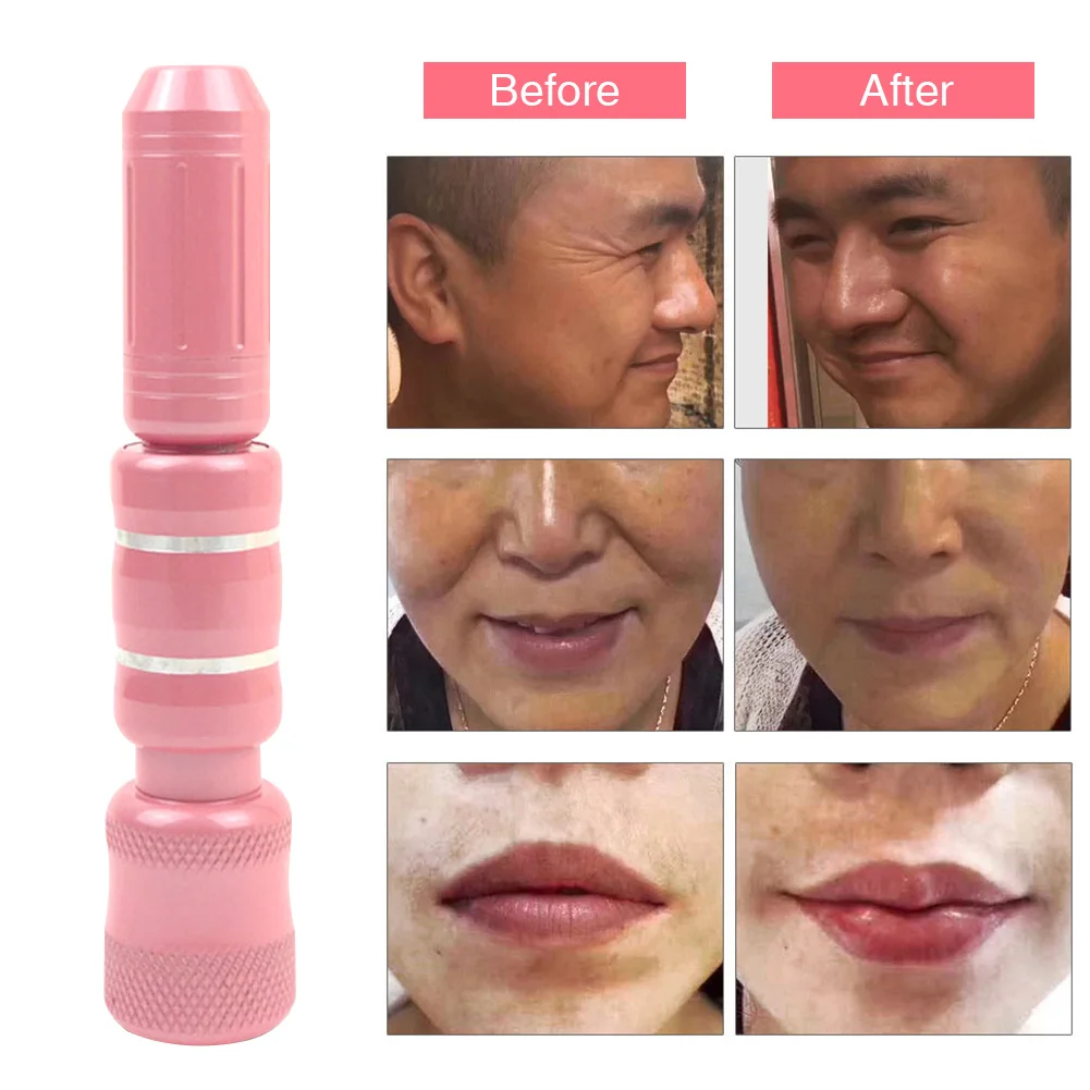 

Multipurpose No Injection Facial Care Skin Rejuvenation Lip Atomizer Hyaluronic Acid Spring Loaded Effective Wrinkle Remove