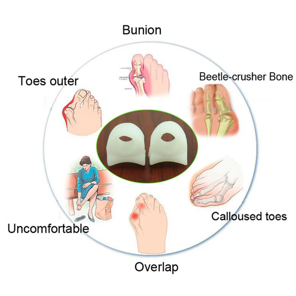 2 шт. силиконовый разделитель для большого пальца стопы|Инструмент ухода за