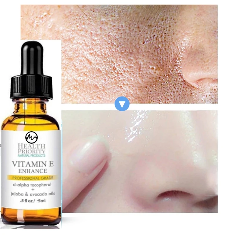 Minch-100-Organic-Vitamin-E-Face-Serum-Natural-Skin-Oil-Anti-Wrinkle-Essence-Oil-Moisturizing-Tight (4)