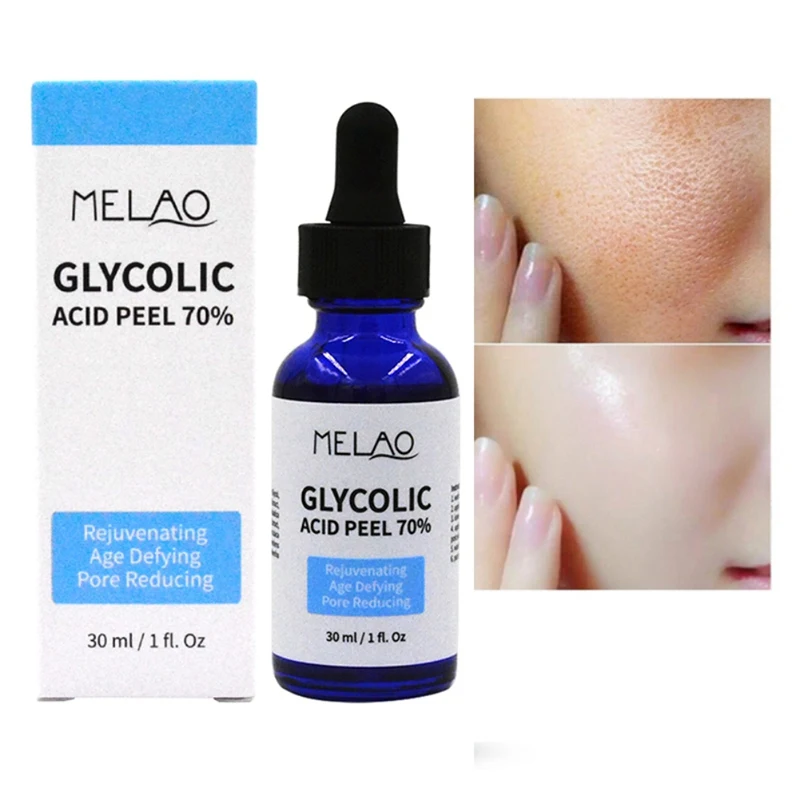 

Face 30ml Glycolic Acid Serum Rejuvenating Age Defying Pore Reducing Moisturizing Face Serum