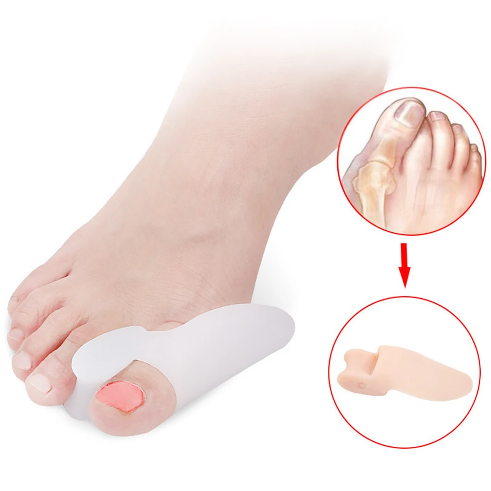 1Pair Gel Foot Care Tool Bunion Corrector Bone Big Toe Protector Hallux Valgus Straightener Toe Spreader Pedicure