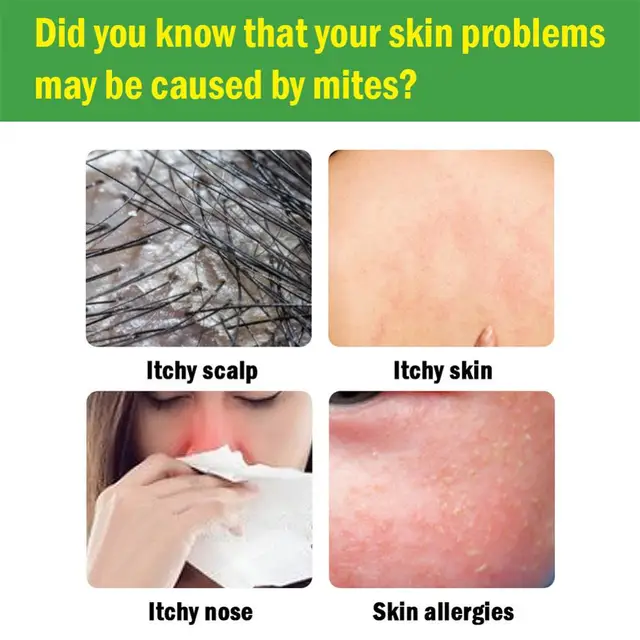 6Db Por Atkák Öld Meg A Természetes Gyógynövény Gyilkos Pusztító Párnát Ölnek Férgek Anti-Mite Pad Párna Otthoni Atka Kontroll - Image 6