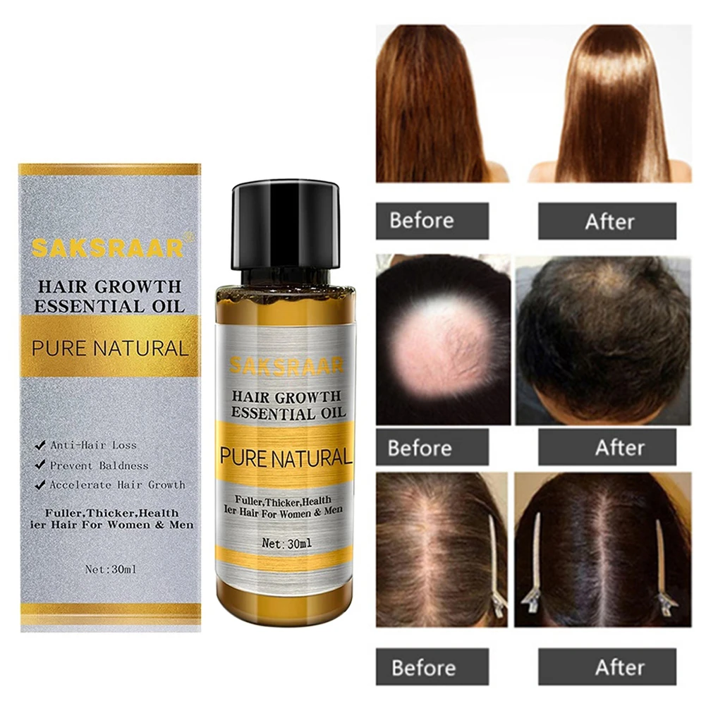 30ml Chinese Medicinal Ginseng Increase Hair Oil Conditioner For Hair Scalp Treatment Repair Fast Nourish Hair Growth Essence Hair Loss Products Aliexpress