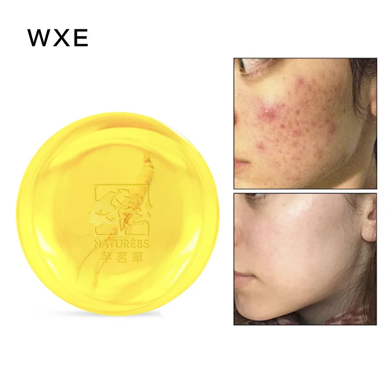 

WXE 100% Natural Matrine Moisturizing Cleansing Soap Effectively Removes Mites and Removes Dirt and Acne Soap whitening soap