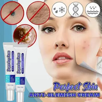 

Herbal Topical Cream Face Pimples Scar Stretch Marks Removal Acne Cream Whiten Face Skin Care Treatment Acne Treatment Blackhead