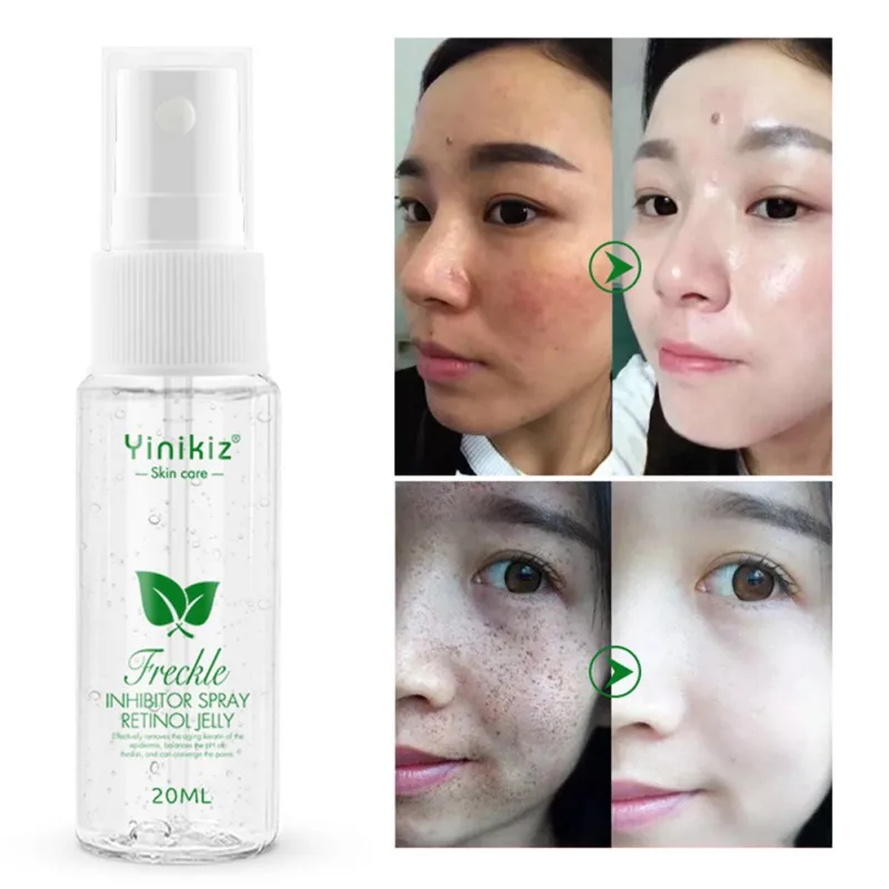 Freckle Removal Serum Moisturizing Lightening Pigment Brighten Skin Color Anti-aging Spray Bright White Pigment SkinCare