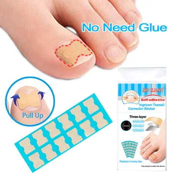 

Ingrown Toenail Corrector Stickers Foot Care Stickers Non Glue Toenail Patch Adhesive Toenail Correction Pedicure Toe Treatment