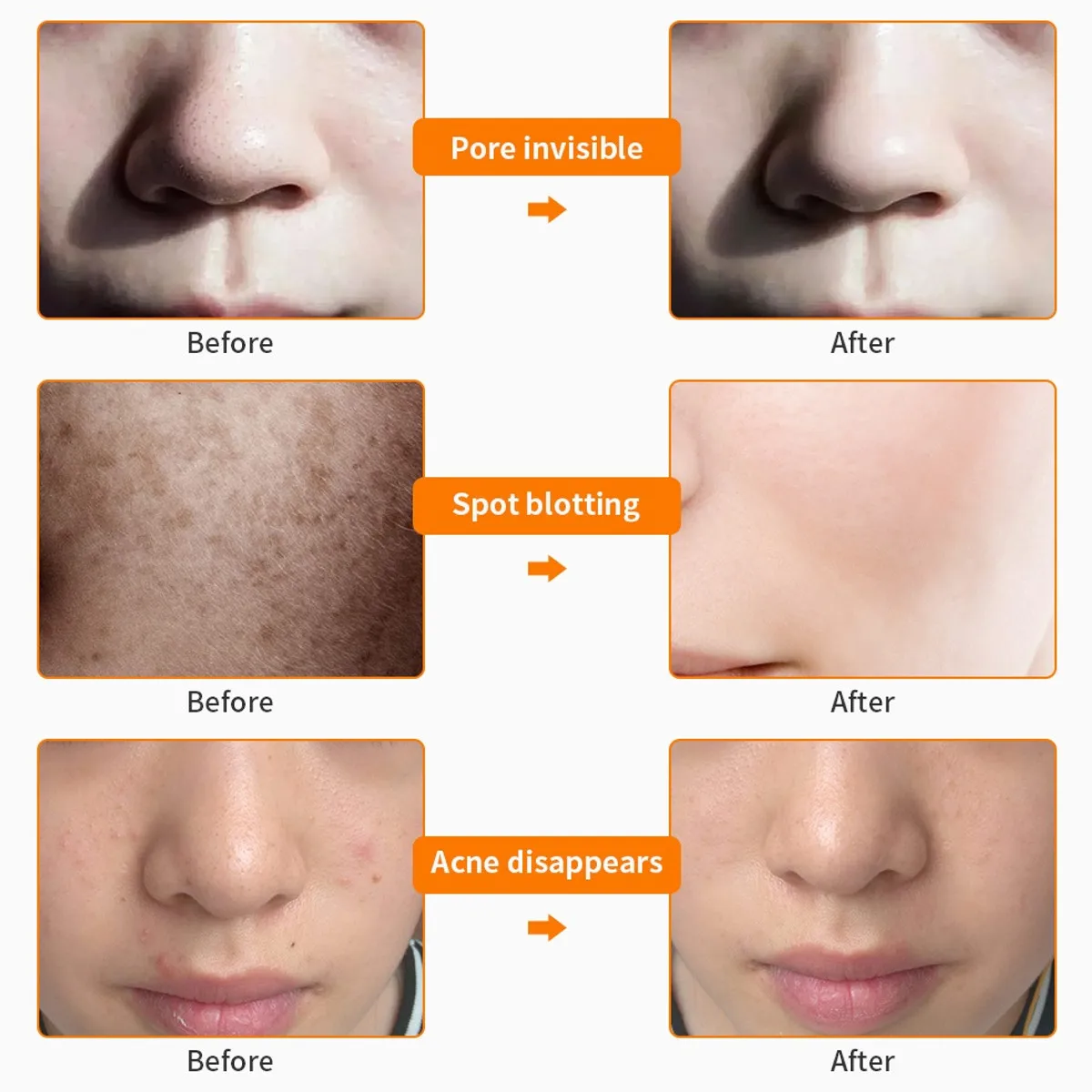 Máscara para Cuidados com a Pele Facial com Pescoço Foreverlily Recarregável Cores Levou Terapia Fóton Rosto Beleza Máscara Estilo Egito 7 Led 12 Cuidados Com A Pele Levou Terapia Fóton