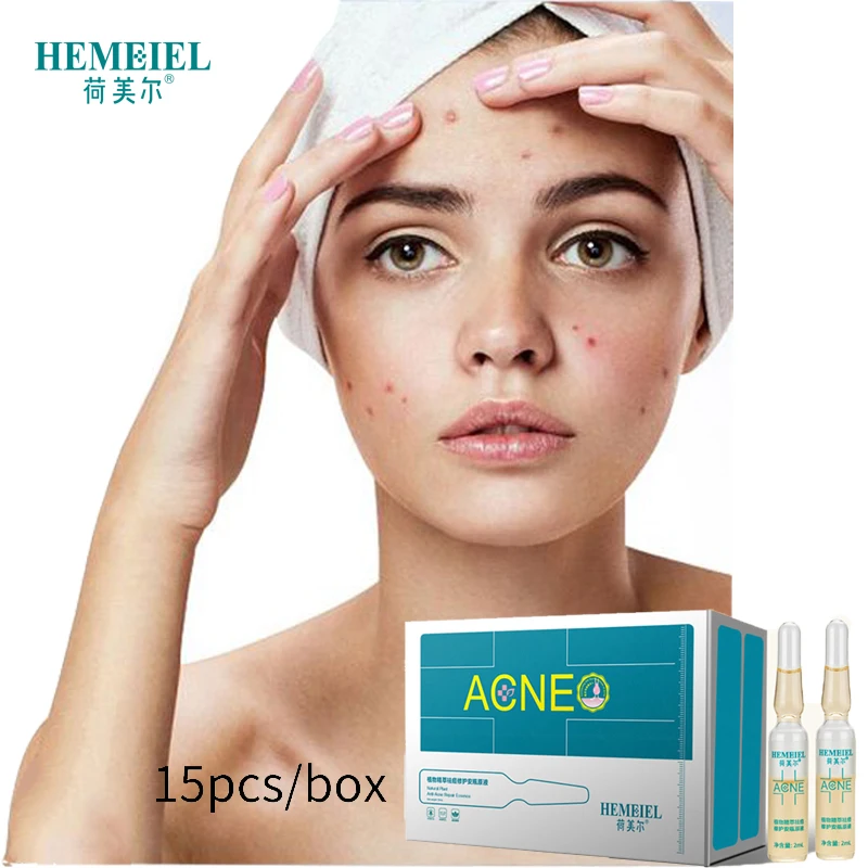 Acne Treatment Essence Natural Herbal Anti-acne Removal Face Serum Skin