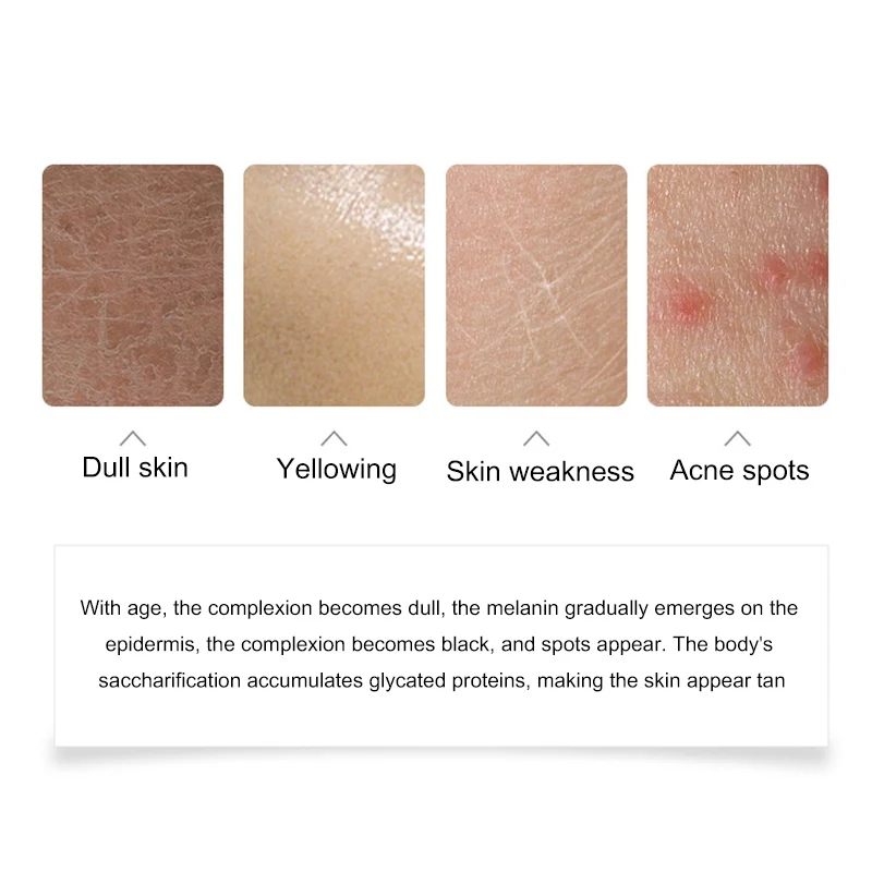 Niacinamide оригинальная жидкость осветляет кожу увлажняющий уход за кожей с сывороткой продукт питательный Горячий