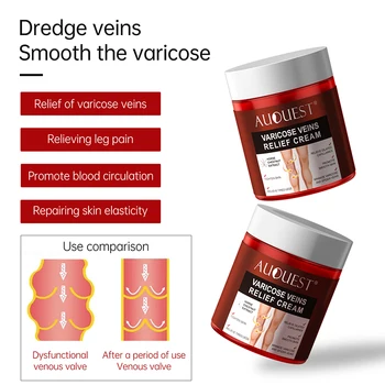 AUQUEST Varicose Veins Relief Cream Vasculitis Phlebitis Spider Pain Relief Ointment Medical Plaster Body Care 80g 4