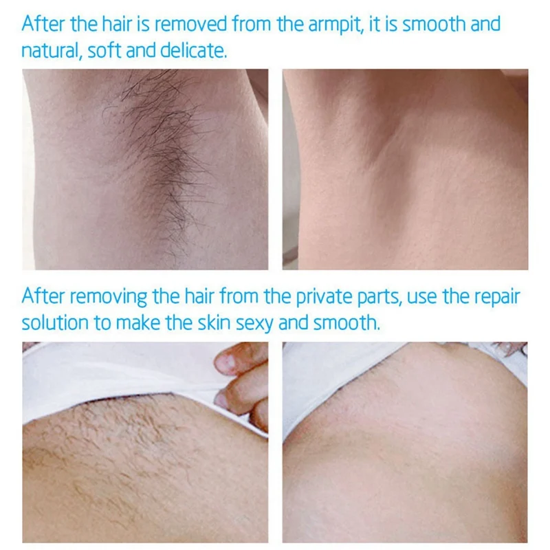 Восстанавливающая эссенция для удаления волос, увлажняющая, сглаживающая кожу, сужающая поры кожи, сыворотка для ухода за кожей