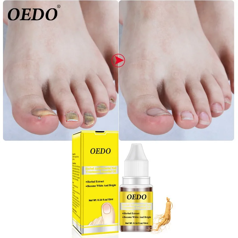 Herbal Antibacterial Nail Treatment Essential Oil Anti Fungus Nourishing Moisturizing Cuticle Nail Oil