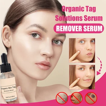 

Hot Seamless Moles Remover Moles Remove Skin Black Moles t6