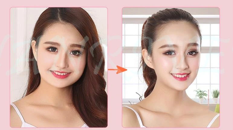 36020170903110148880_meitu_5