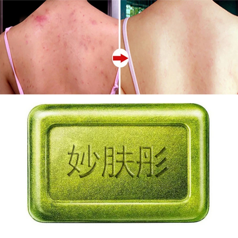 Rffective Handmade Tea Tree Oil Soap Mites Removal Soap Anti-mites Shrinking Pores Rffective Handmade Tea Tree Oil Soap Mites Removal Soap Anti-mites Shrinking Pores