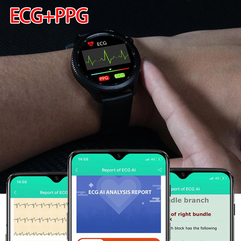 Smart Watch Orologio Elettrocardiogramma Polso NORTH EDGE ECG