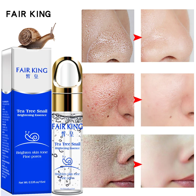 

Moisturizing Skin Pore Hyaluronic acid Snail Plant Extract Face Serum Whitening Blemish Serum Anti-acne Treatment Facial Essence