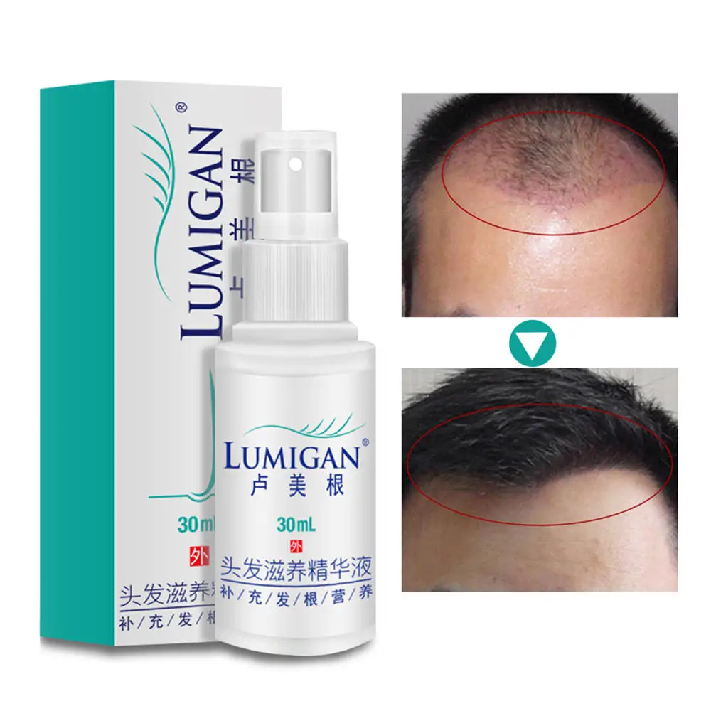 Fast-Sunburst-Hair-Growth-Products-Hair-Spray-Essence-Anti-Hair-Fall-Loss-Treatment-Women-Men-Grow (2)