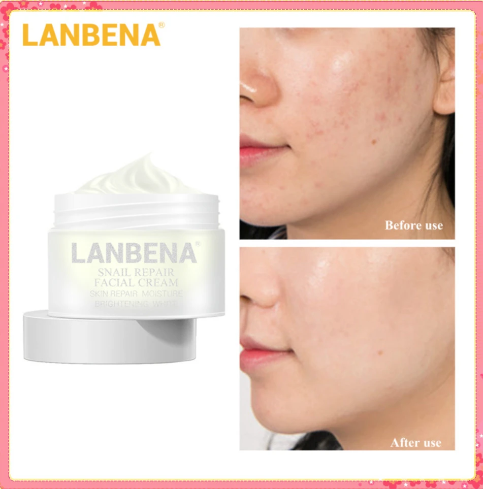 

LANBENA Snail Repair Whitening Facial Cream Day Cream Anti Wrinkle Anti Aging Acne Treatment Moisturizing Firming Skin Care 30g