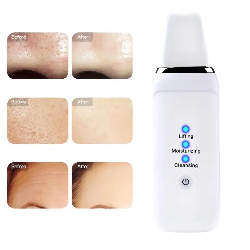 Ultrasonic Skin Scrubber Deep Face Cleaning Machine Face Lifting Massager Machine Exfoliating Pore Cleaner Skin Care Tools