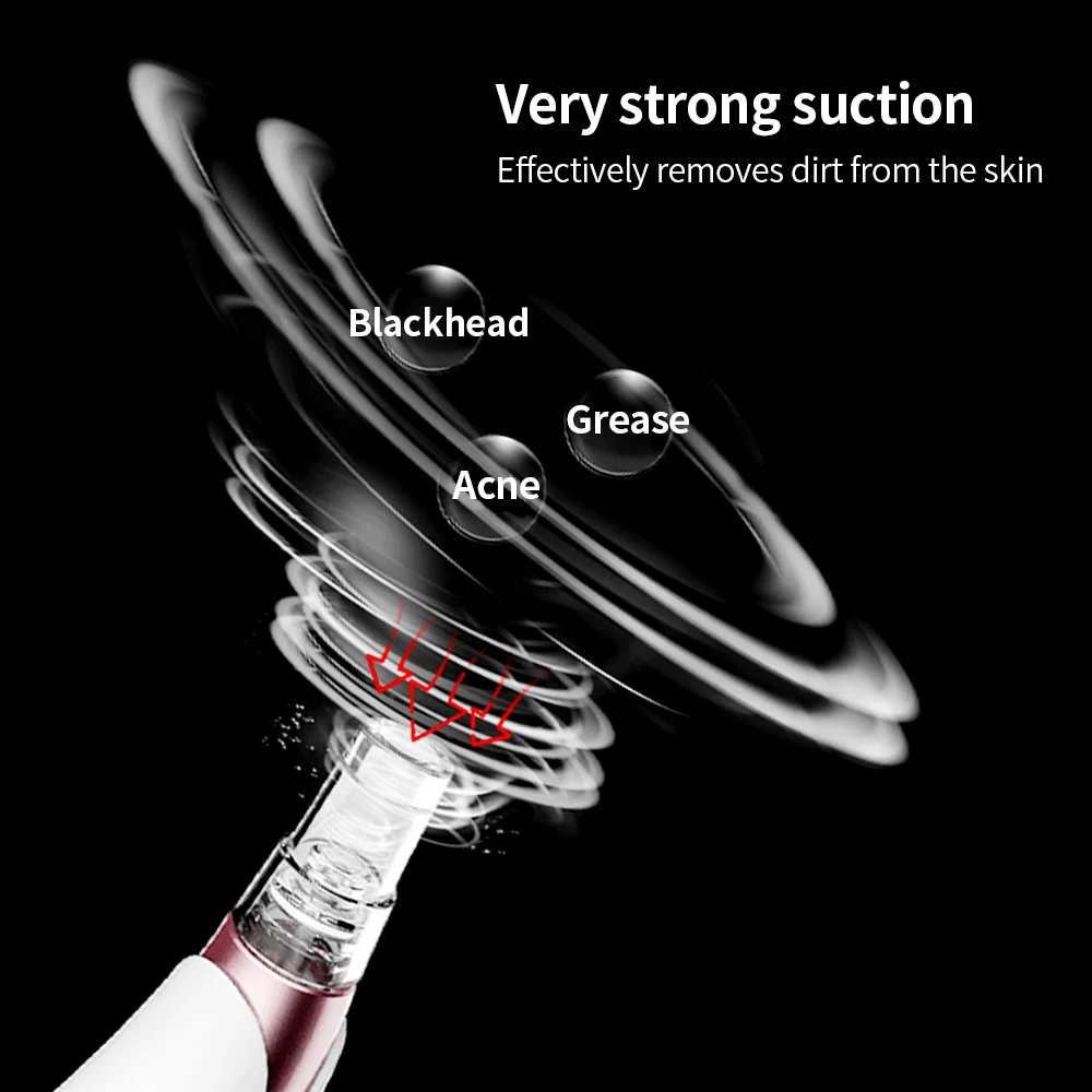 От прыщей давить прыщи Поры вакуумное устройство для удаления черных точек артефакт электрическое всасывание лица чистящий аппарат красоты машина акне угрей вакуум для лица акне уход за лицом прыщи инструменты