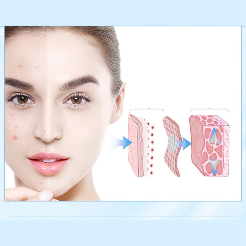 Эффективно Acne Mark ремонт гелевый Увлажняющий Осветляющий пигмент уход за кожей, акне лечение угрей яма усадка поры уход за кожей лица Горячий