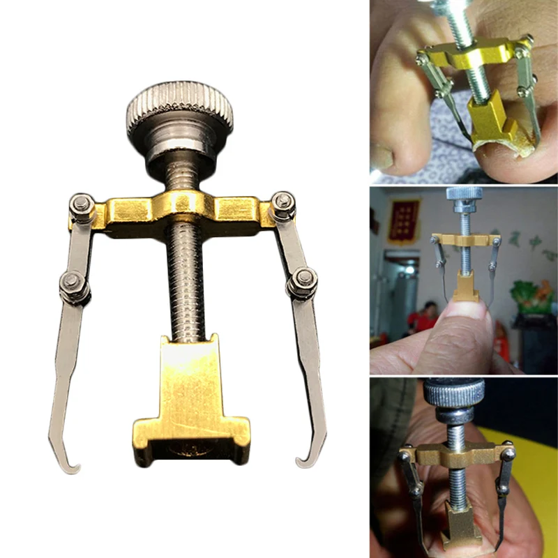 1pcs Pedicure Tool Для вросших ногтей, педикюра, инструмент для ухода за ногами, инструмент для коррекции ногтей, кусачки для коррекции ногтей, для ортопедического акрокса, средство для удаления омертвевшей кожи, Podiatry - Цвет: 1pcs Pedicure Tool