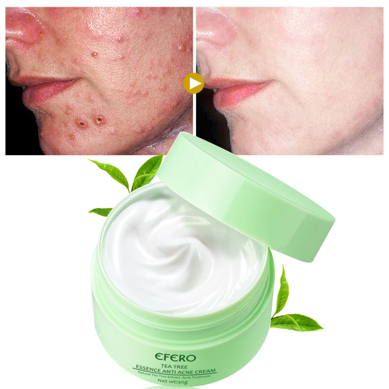 Tea Tree Anti Acne Treatment Face Cream Whitening Moisturizing Cream Shrink Pores Oil Control Anti Aging 2
