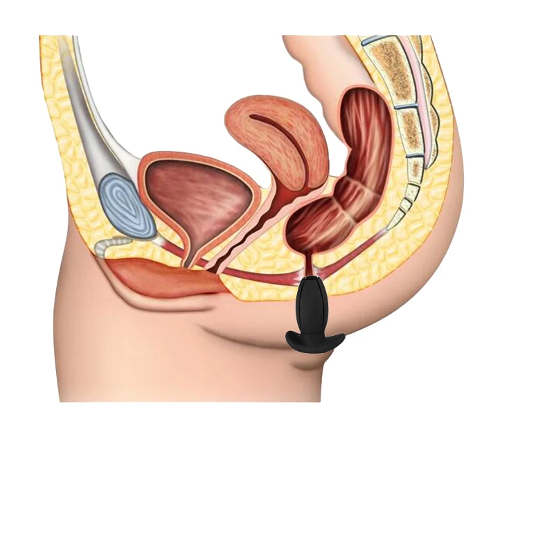 Wetips Enema Anus расширение биде душ дилататор анальный отверстие для очистки ануса Вилка портативный биде груша для промывки ануса Анальная пробка отверстие
