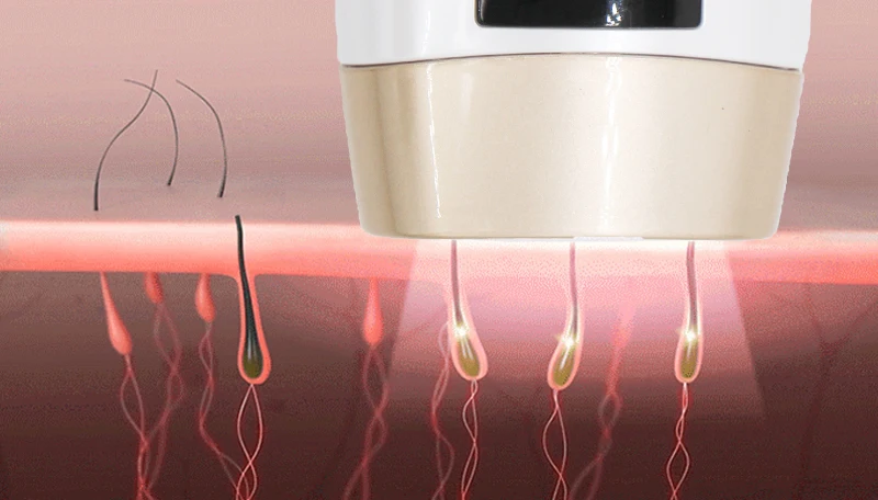 Mini Handheld Laser Epilator Depilador Facial Permanent Hair Removal Device Whole Body Laser Hair Remover Machine 500000 Flashes Mini Handheld Laser Epilator Depilador Facial Permanent Hair Removal Device Whole Body Laser Hair Remover Machine 500000 Flashes