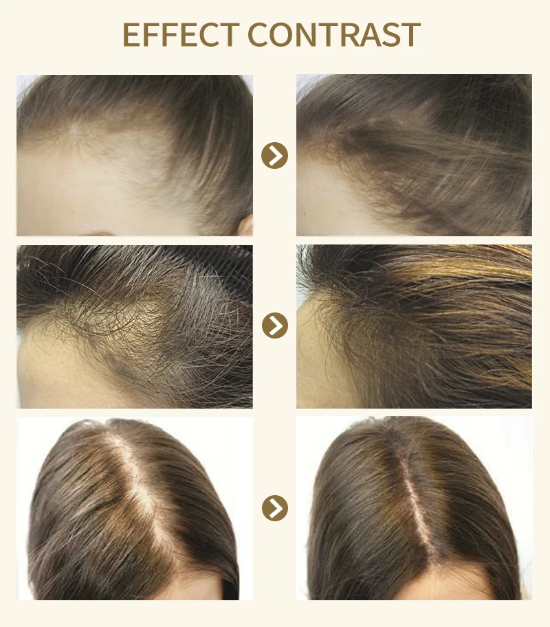 生姜香皂-恢复的_08