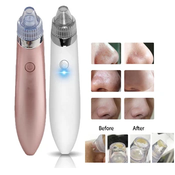 

Blackhead Remover Face Deep Pore Cleaner Removal Vacuum Suction Facial SPA Diamond Beauty Care Tool Skin Care Electric Cleaner