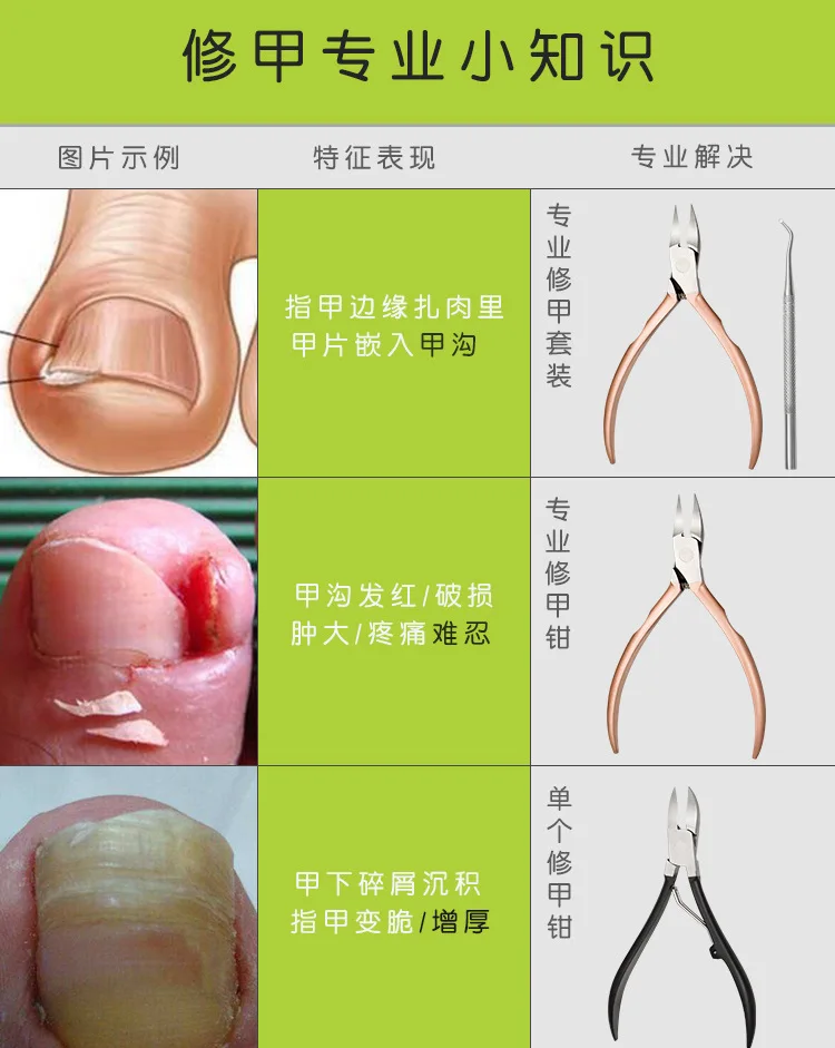 Manufacturers Direct Selling Yangjiang Stainless Steel Hairdressing Clamp Ingrown Toenails Clamp Manicure Clamp Olecranon Manicu