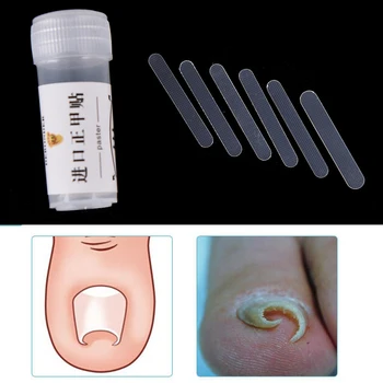 

5pcs/box Patch Paronychia Correction File Acronyx Wire Corrector Ingrown Toe Nail Correction Sticker Foot Care Tool