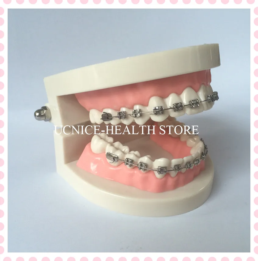 2-кратная демонстрация ортодонтической модели зубов для пациентов с