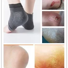 1 пара, новые гелевые носки для пятки, увлажняющие гель-содержащие спа-носки, уход за ногами, трещины, сухость ног, Жесткий протектор кожи, опт или розница