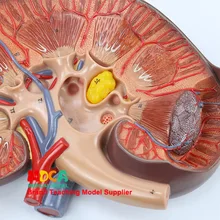 Человеческий усилитель 3 раза 2 части надпочечная анатомическая Урология роскошная модель почек обучение медицине Msz006