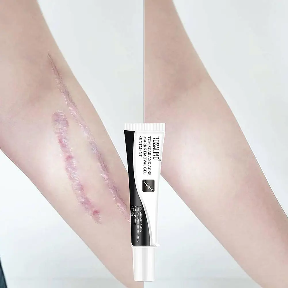 

Scar Removal Cream Burn Scar Marks Relief Skin Tightening Gel For Men Women Scar Removal Cream Body Care Tools