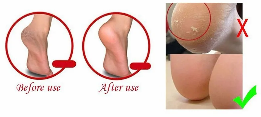 Silicone Gel Heel Protection Socks Relieve Heel Pain Moisturizing Whitening Cover Heel Cup Surpports Foot Care Protector