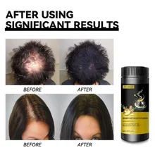 

Ginger Hair Growth Regrowth Fiber Powder For Men Produit Pour Repousse Cheveux Hairline Polvos Para El Pelo Haargroei Beleza