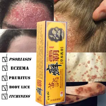 

Select Ba Miao Herbal Ringworm Ba Herbal Cream, Cream, Foot and Special Foot Antipruritic, Hand Hand and Treatment of O9J3
