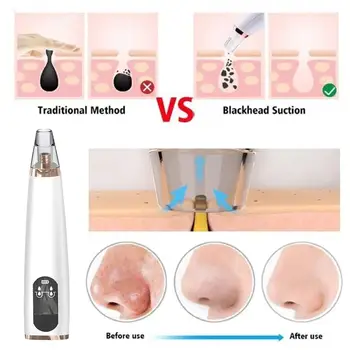 

USB Electric Acne Blackhead Remover Vacuum Extractor Black Machine Tool Skin Spots Pore Pore Care 6 head Cleaner Cle J4C9