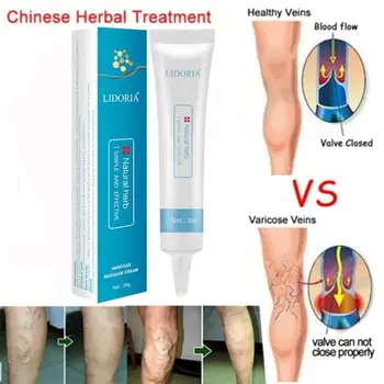 

Varicose Veins Ointment Vasculitis Treatment Phlebitis Angiitis Inflammation Blood Vessel Rotten Legs Varicose Veins Cream