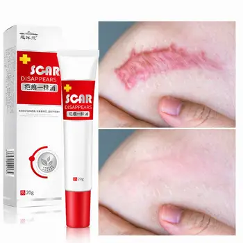 

Remove Scars Acne Cream Stretch Marks Treatment Maternity Repair Anti-Wrinkles Firming Body Creams Scar Removal Cream